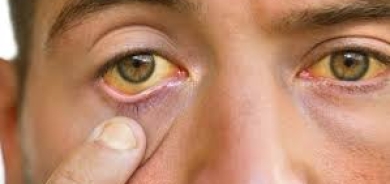 اكتشاف إنزيم في بكتيريا الأمعاء يمنع اليرقان