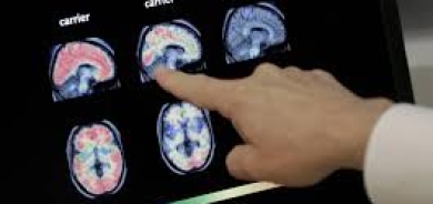 3 نصائح لتقليل خطر الإصابة بالخرف والسكتة الدماغية والاكتئاب