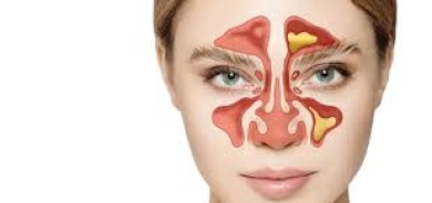 الجيوب الأنفية... 8 معلومات حول سلامتها