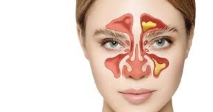 الجيوب الأنفية... 8 معلومات حول سلامتها