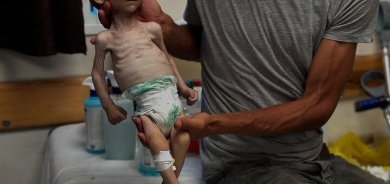 لە یەک ڕۆژدا ٨٠ منداڵی فەلەستینی لە غەززە بەهۆی برسێتی گیان لەدەست دەدەن