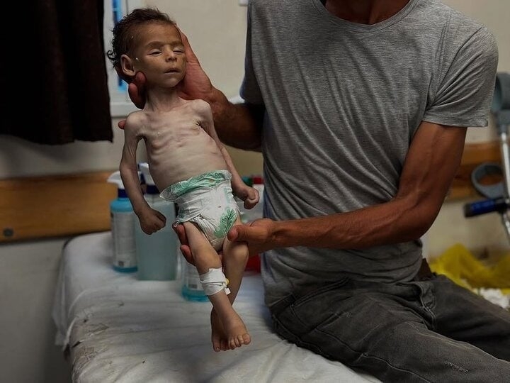 لە یەک ڕۆژدا ٨٠ منداڵی فەلەستینی لە غەززە بەهۆی برسێتی گیان لەدەست دەدەن