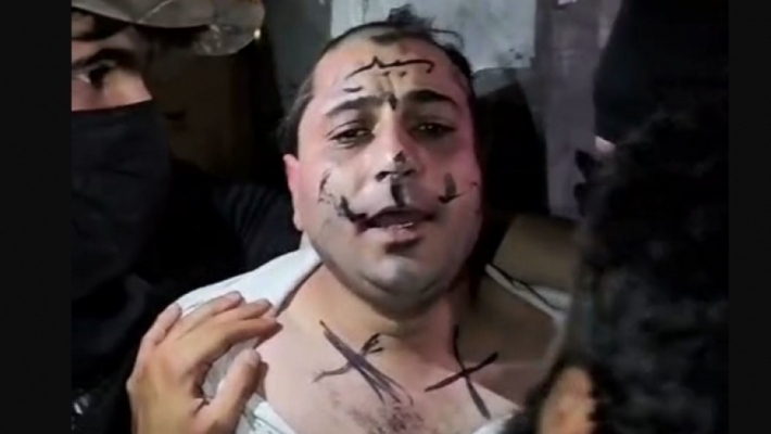 Hunermendê Sûrî rastî heqaret û lêdanê hat û porê wî hat jê kirin