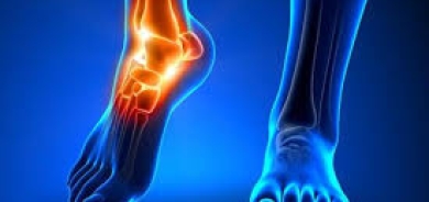 علاج لهشاشة المفاصل دون جراحة