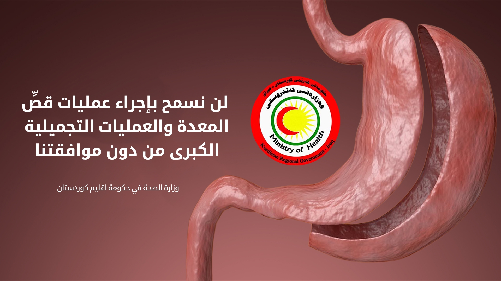 صحة كوردستان تسمح بإجراء عمليات قصِّ المعدة.. لكن بشروط!