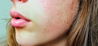 تظهر على بشرتك... 6 علامات تكشف أن جسمك يمتص فيتامين «سي» بالطريقة الصحيحة