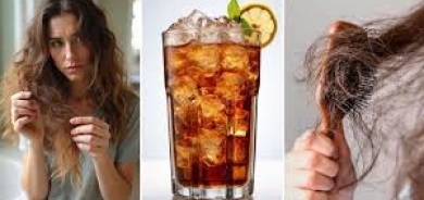 دراسة: المشروبات السكرية تؤدي إلى تساقط الشعر