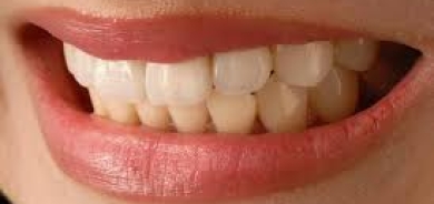 لون أسنانك يكشف عن صحتك... إليك ما يقوله العلم