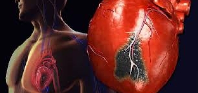 النوبة القلبية أم السكتة القلبية... ما الفرق بينهما؟