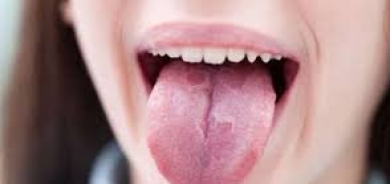 متلازمة حرقة الفم... احذر من 4 أعراض رئيسية