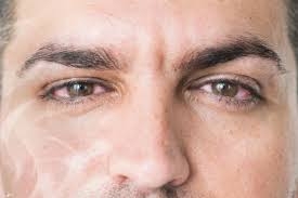 التدخين يمكن أن يسبب ضرراً دائماً للعينين