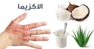 مواد غذائية تساعد في علاج التهابات الأكزيما