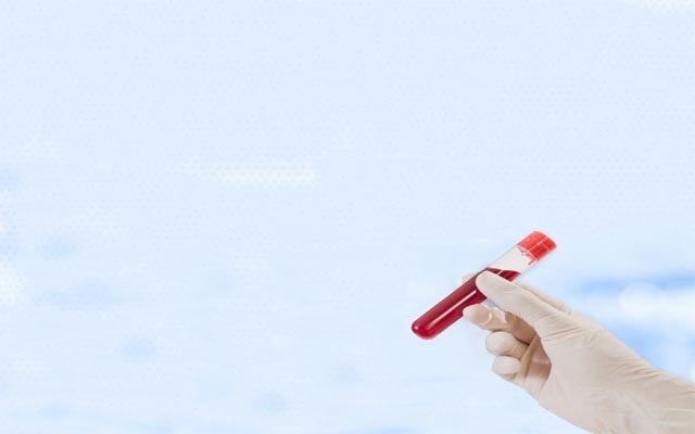 گرنگیی  پشكنینی گشتیی خوێن