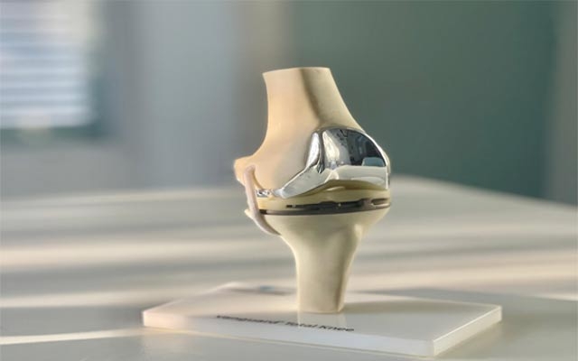 كەی جومگەی دەستكردی ئەژنۆ پێویست دەكات؟