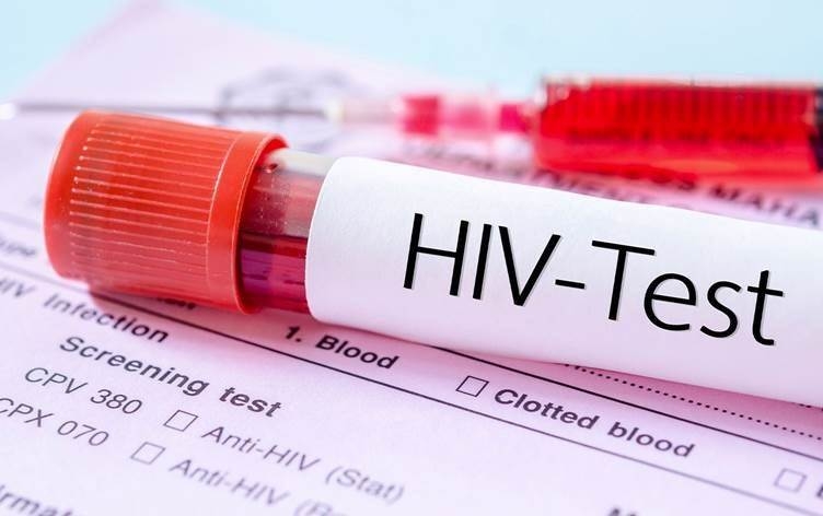 Li Herêma Kurdistanê AIDS zêde dibe: Sedem çi ne?