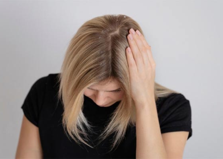 هۆكاری سەرەكیی توێشكی سەر