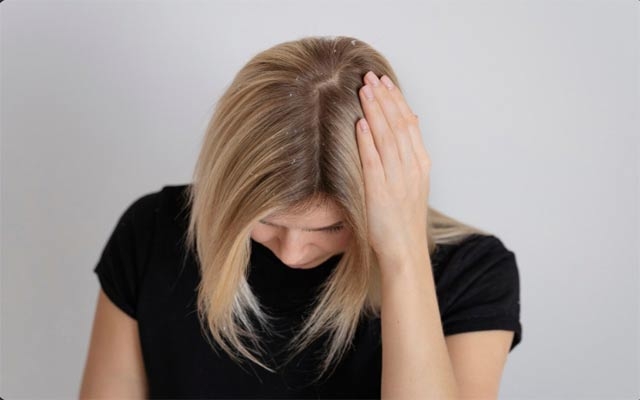 هۆكاری سەرەكیی توێشكی سەر