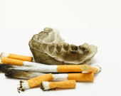 جگەرەكێشان ئەگەری شێرپەنجەی دەم تا دە جار زیاد دەكات