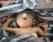 بۆ زانیاریت، تاقەچاوی (Cyclopia)