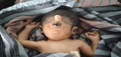 بۆ زانیاریت، تاقەچاوی (Cyclopia)