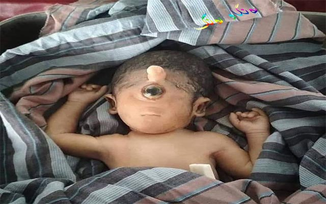 بۆ زانیاریت، تاقەچاوی (Cyclopia)