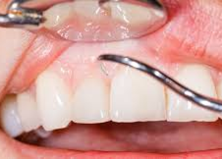 لون اللثة... أداة رقمية تكشف عن صحة الجسد قبل ظهور الأعراض