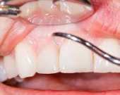 لون اللثة... أداة رقمية تكشف عن صحة الجسد قبل ظهور الأعراض