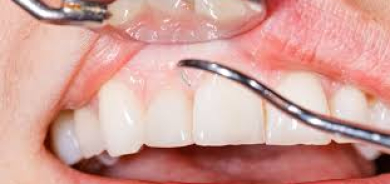 لون اللثة... أداة رقمية تكشف عن صحة الجسد قبل ظهور الأعراض