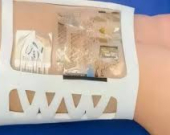 جهاز مبتكر لمراقبة التوتر المزمن