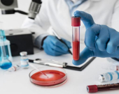 گرنگیی پشكنینی پرۆتینی CRP