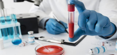 گرنگیی پشكنینی پرۆتینی CRP