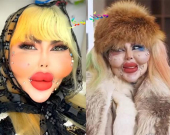 دیمەنە سەیرەكان، 338 نەشتەرگەری جوانكاری