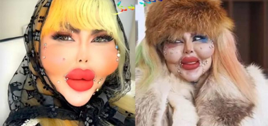 دیمەنە سەیرەكان، 338 نەشتەرگەری جوانكاری