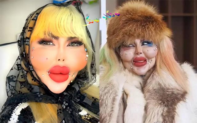 دیمەنە سەیرەكان، 338 نەشتەرگەری جوانكاری