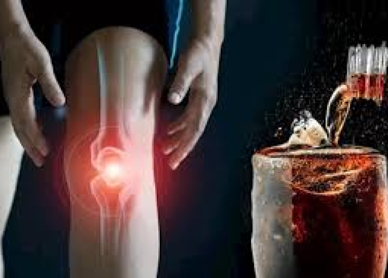 ما تأثير المشروبات الغازية على العظام؟