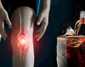 ما تأثير المشروبات الغازية على العظام؟