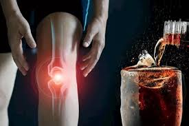 ما تأثير المشروبات الغازية على العظام؟