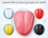 لسانك لا يكذب… «بصمة تنبئية» للأمراض