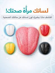 لسانك لا يكذب… «بصمة تنبئية» للأمراض