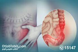 ما الذي يحدث لأمعائك أثناء نوبة القولون العصبي وكم تدوم عادةً؟