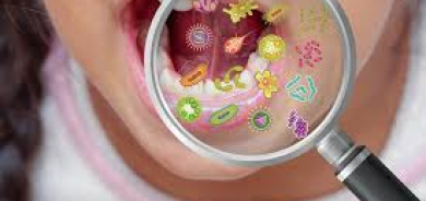 بكتيريا الفم قد تتسبب في سرطان المعدة