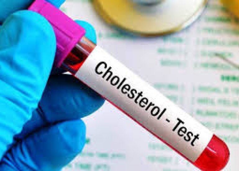 كم مرة يجب عليك فحص مستوى الكوليسترول بالدم؟