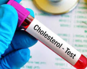 كم مرة يجب عليك فحص مستوى الكوليسترول بالدم؟