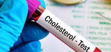 كم مرة يجب عليك فحص مستوى الكوليسترول بالدم؟