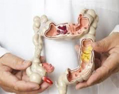 خراپترین  خۆراكەكان بۆ گرژبوونی كۆلۆن