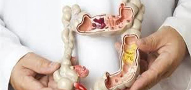 خراپترین  خۆراكەكان بۆ گرژبوونی كۆلۆن