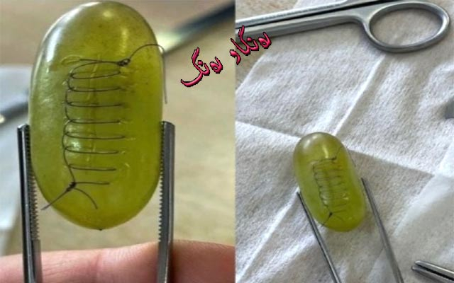 نەشتەرگەری و دوورینەوەی میوەكان