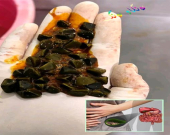 دیمەنە سەیرەكان،  ئەمە دیمەنی بەردی زراوە لە ناو لەشی مرۆڤدا
