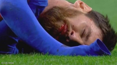 ميسي ينزف مجددا.. ويخضع للكشف بعد 