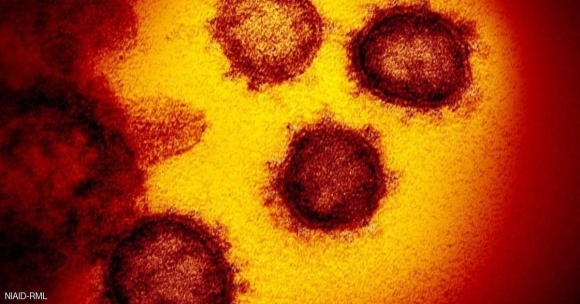 شاهد اول صورة عالية الدقة لفيروس 